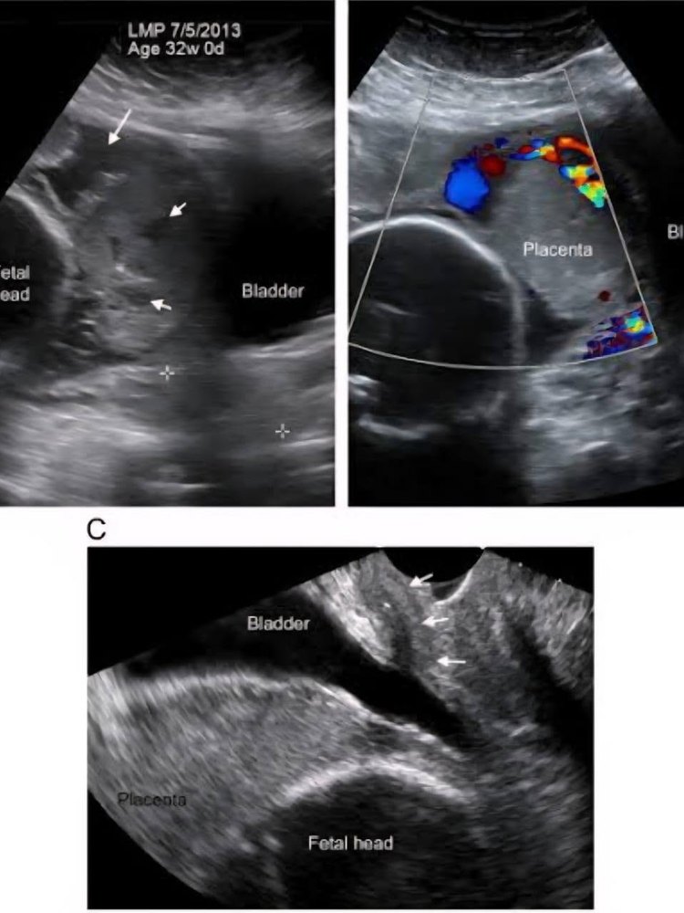 Example ultrasound imaging output