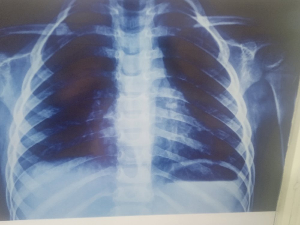 Example X-ray imaging output